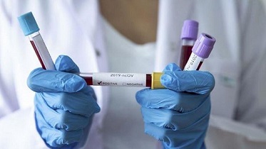 El 14% de los infectados pertenece al personal de la salud