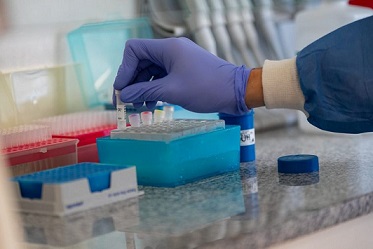 Son 54 los muertos por coronavirus en el país