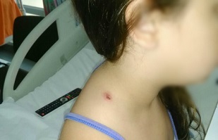Una nena de 6 años, herida por una bala perdida en Rosario