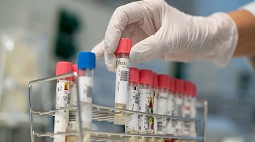 Ya son 136 los fallecidos por Covid-19 en Argentina
