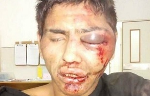 Robó un celular, lo atraparon y le dieron una brutal paliza