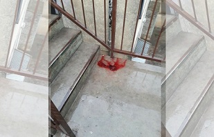 Agoniza en San Luis un chico baleado en la cabeza